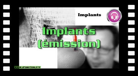 Implants (émission)