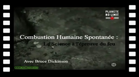 Combustion Humaine Spontanée : La science à l'épreuve du feu