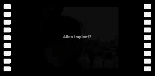 Alien implant ?
